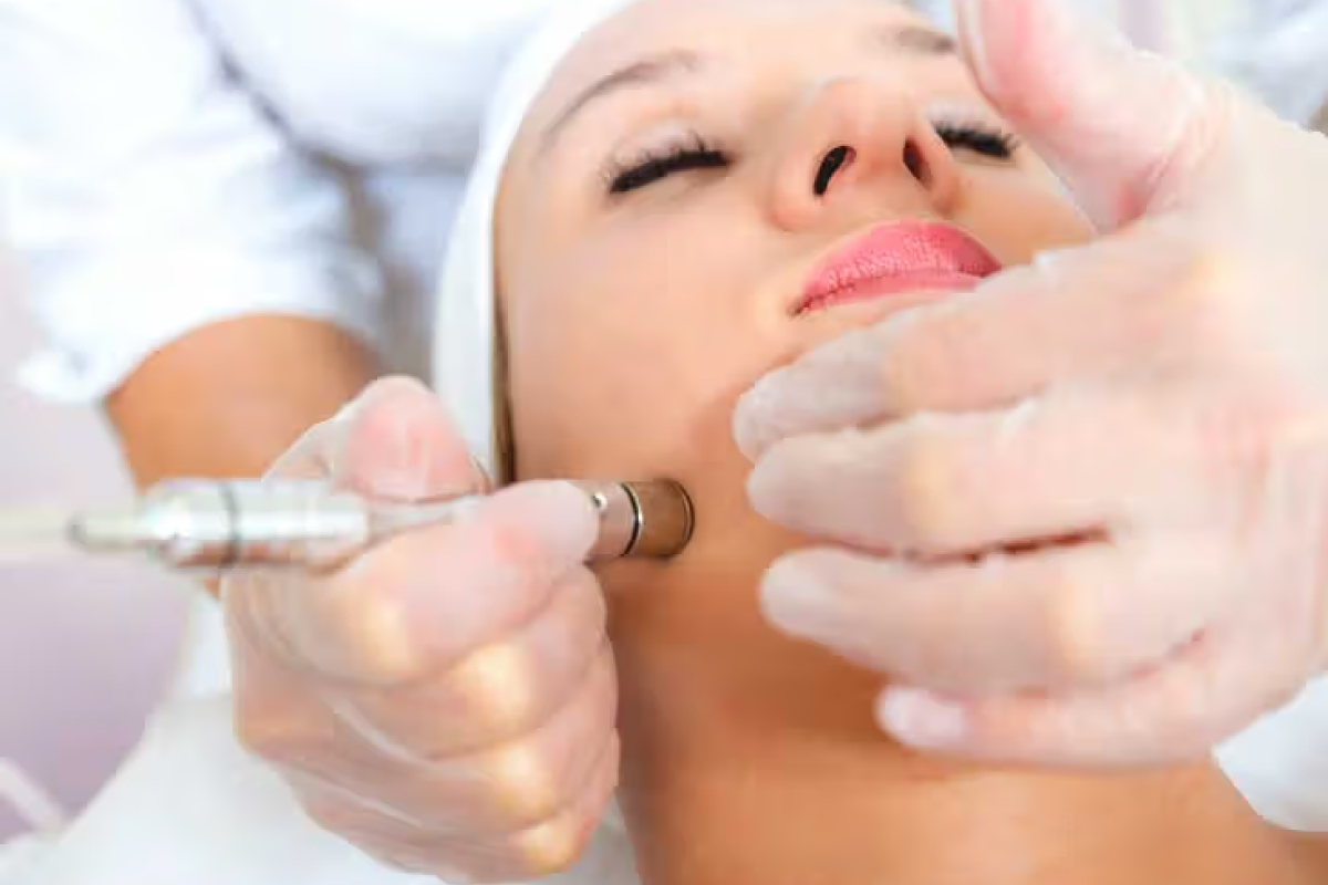 Microdermabrasion